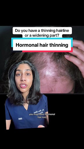 Effective Solutions for Androgenetic Alopecia