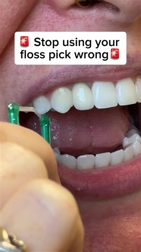 Stop using your floss pick wrong! 🦷👀 If you’re snapping the floss straight down between your teeth and pulling it right back up, you’re missing an important step. Gently curve the floss around each tooth in a C-shape and move it up and down along the sides of the tooth and slightly under the gumline. That’s where the plaque likes to hide! 🪥✨ Save this for your next flossing session & send it to someone who needs the reminder! #GoldStandardDentistry #DentalTips #FlossingTips #OralHealth #Denti