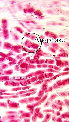Differnet Mitosis Stages of Onion root tip. #cells #mitosis #microscope