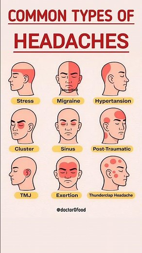Common Types of Headaches Explained | Migraine, Stress, Sinus & More | Causes & Symptoms Guide
