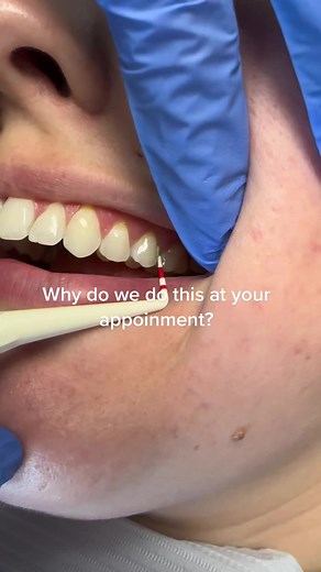 Importance of Periodontal Chart in Preventing Gum Disease