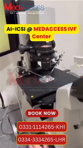 🔬 Inside Our Lab – ICSI in Action 💉🧫 Witness the precision and science behind our ICSI (Intracytoplasmic Sperm Injection) procedure, performed at MedAccess Advance Lab. In this advanced fertility technique, a single healthy sperm is directly injected into a mature egg under high-resolution microscopy — increasing the chances of successful fertilization, especially in cases of male infertility or previous IVF failures. 🧪 Trusted technology 👨‍⚕️ Expert Embryologist 🌟 Hope for parenthood Beca