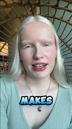 Albinism: A rare condition with a unique kind of beauty. 🌟 #AlbinismAwareness"