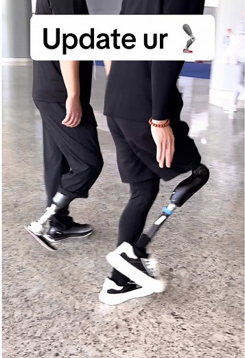 Upgrade to Advanced Microprocessor Prosthetic Legs in 2026