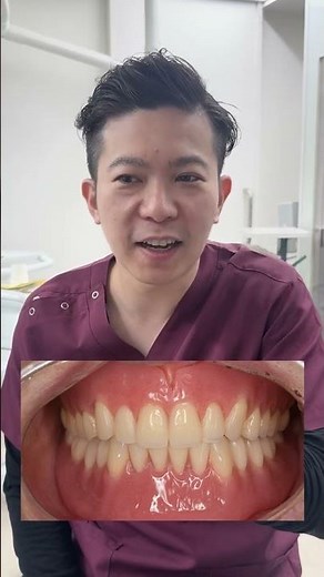 [Before and After] You can get stable dentures made with insurance coverage! [Dentures]