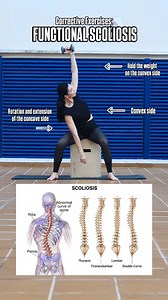 This side–bend exercise can be helpful for functional scoliosis, but it is especially effective for improving thoracic side mobility and correcting general asymmetries. when performed with the weight on the convex side of the curve. Holding the weight on the convex side strengthens the longer, weaker muscles and allows the concave side to open and decompress. This helps improve symmetry, thoracic mobility, and overall postural balance. Overall, it’s a great choice for anyone with limited lateral