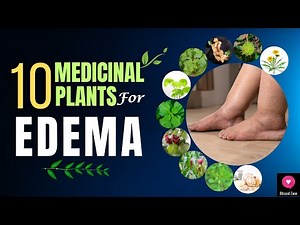 Top 10 Medicinal Plants for EDEMA - Natural Remedies for Swelling and Fluid Retention | Blissed Zone
