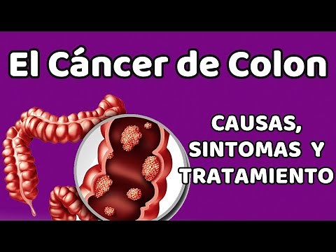 EL CÁNCER DE COLON, Causas, signos y síntomas, diagnóstico y tratamiento