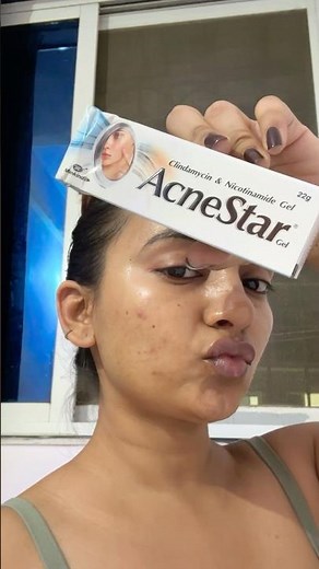 #shortsfeed How to use acne star gel on pimple #acne #skincare #skincaretips #pharmacy #pimple