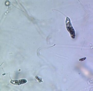 Euglena