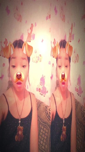 yg l mni type