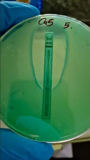 تحدي لعشاق الميكرو.. تعرف إيه هو الاختبار ده واسمه ايه ؟ (E-test)👀 #microbiology #bacteria #معمل