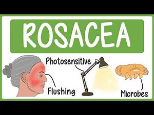 Rosacea in 3 Minutes