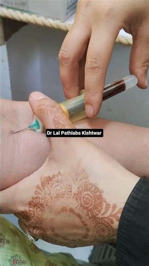 Dr Lal Pathlabs | Vacutainer Blood Collection | Your Healthcare Partner #drlalpathlabs #stayhealthy