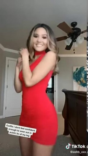 Stylish Amputee Girl Beauty Styling in Different Dresses | One Legged Girl with Artificial Leg Dress