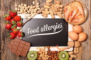 Food Allergy Course Online | £10 VAT | 35mins | Fully Accredited