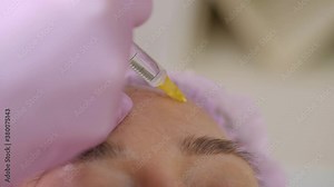 Cosmetologist makes the Rejuvenating facial injections procedure for tightening and smoothing wrinkles on the face skin of young woman in a beauty salon