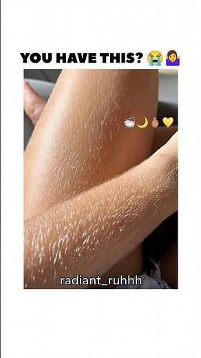Hairy Body? Try This😳#hairremoval #unwanted #hair #glowup #beautytips #remedy #fypシ #shorts