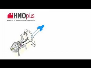 Anwendung Ohrentropfen