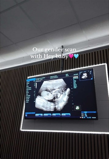 Our Gender Scan Experience with Hey Baby 4D
