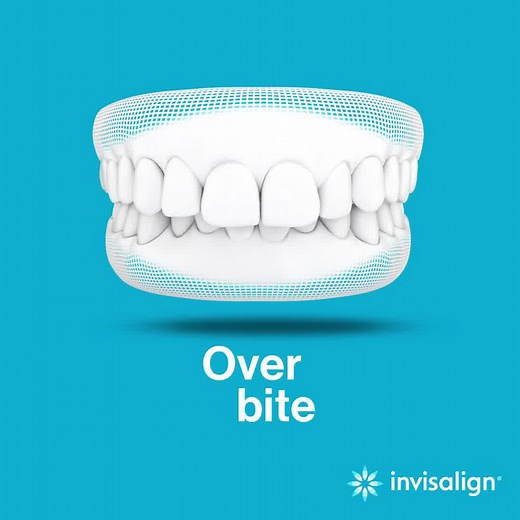 Pair the most advanced clear aligner system in the world with the care of an expert, and see teen smiles transform. Start now! | Invisalign