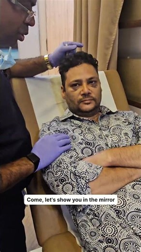 Rhinoplasty Transformation! Broad Nose to Defined Tip | Splint Removal Reaction #drrajatgupta