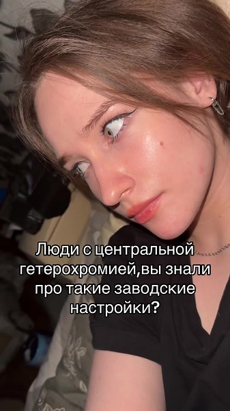 Гетерохромия: Узнайте о её видах и особенностях