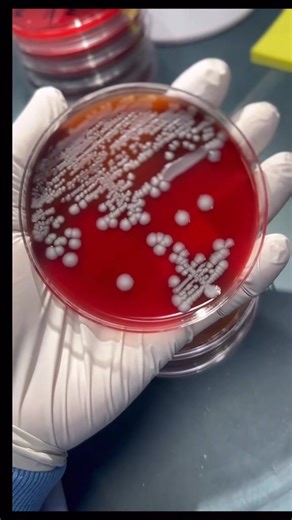 Microbiology is fun 😁 Gram negative rod and Indole negative | Lab life