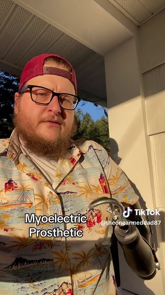 Practical Use of Body Powered Prosthetic Hooks