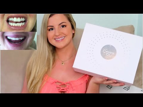 Candid Clear Aligners Update | Is it Worth it?! (WITH BEFORE AND AFTERS)