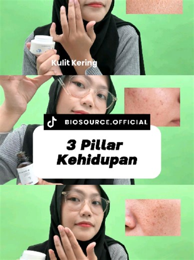 Stop bingung cari skincare yang cocok! 🙅‍♀️ Tiap masalah kulit butuh penanganan yang tepat. • ​Kulit Kering? \\rightarrow Moisture Gel (4x Ekstra Lembab) • ​Kulit Berjerawat? \\rightarrow Anti Acne Serum •​Flek Hitam/Tanda Penuaan? \\rightarrow Retinal Cream ​Ucapkan selamat tinggal pada masalah kulitmu! ✨ #Biosource #skincareviral #moisturizer #antiacneserum #retinalcream