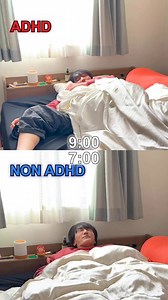ADHD VS NON ADHD: Which one are you?? #shorts #issei #issei0806 #funny #edit #meme #reaction #viral #trending #entertaining | ISSEI いっせい