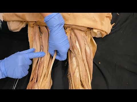 Legs are fine! Lower Extremity Anatomy | Dissection Course Live Anatomy Innsbruck