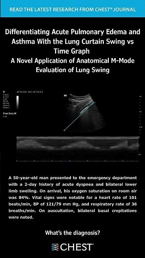 Ultrasound Corner: Differentiating Acute Pulmonary Edema & Asthma w Lung Curtain Swing vs Time Graph