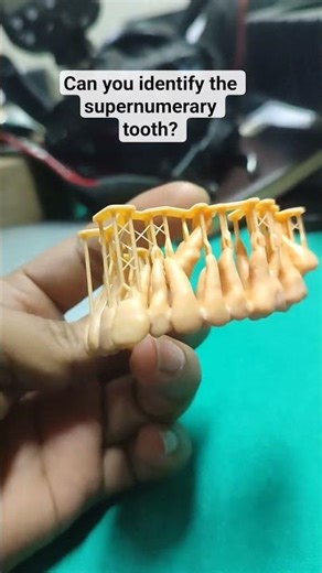Which is the supernumerary tooth?