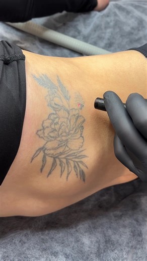 Моя улюблена справа це повертати людям чисту шкіру 🥰 То ж запрошую і тебе 🙏🏻 Студія в Києві , 1хв від метро Голосіївська . #видаленнятату #видаленнятатукиїв #picolaser #видаленнятатуювання #татувидаленнякиїв