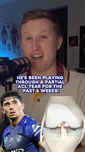 Playing through a partial ACL tear without missing time?!? Almost unheard of, but that’s been the reality for Bailey Simonsson over the past 6 weeks. Unfortunately now the damage to his ACL has worsened & will require surgery. Quite the combo of toughness high performance! #nrl | NRL Physio