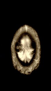 33 reactions | The Human Brain! 易 #Anatomy #Brain #Halloween #MRI #Art #frankenstein #Gothaf | Jay Baron | Facebook