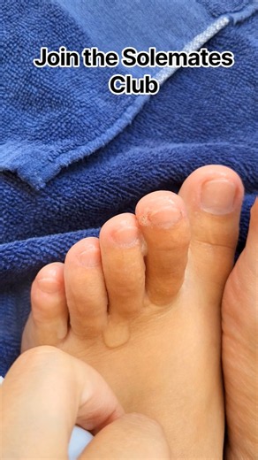 Spray my Toes: Home Feet Care