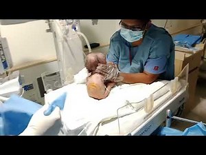 Lumbar puncture in sitting position by Dr. Venkatesh. H A