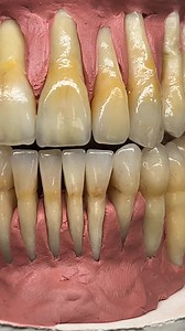 192K views · 737 reactions | So sad Most of Denist did not knows nor understanding what natural teeth look like …..here is the guide what I made 25 years ago with ceramics…. | Luke Kahng | Facebook