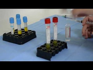 Plasmagel cuarta generación SMI Equipments