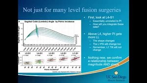 Using L1PA to Set Sagittal Alignment Targets