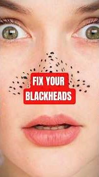 How to Fix Blackhead Easily 😱