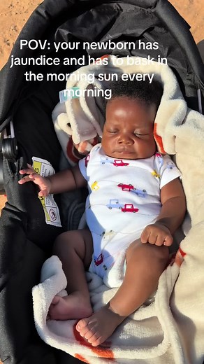 Understanding Jaundice in Newborns: Signs and Care Tips