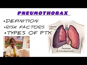 Pneumothorax Types & Risk Factors Explained | ICU & Medical Guide