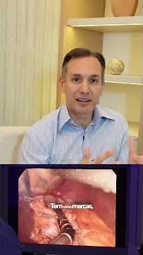 Como é feita uma cirurgia bariátrica por vídeo, passo a passo por dentro da técnica.