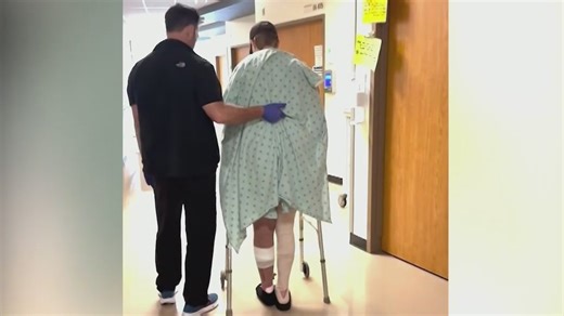 Burned Fort Worth firefighter to get workers' comp after outrage over denied care