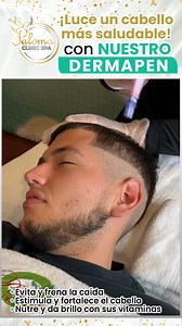 Dermapen Capilar: tratamiento para la caída del cabello para Hombres. y Mujeres. Vive para ti, quiérete en Paloma Clinic Spa 🕊 Te contamos sobre los beneficios que tu cabello obtiene por el tratamiento Dermapen✨ Fortalece tu cuero cabelludo Tecnología para mejorar tu cabello: más efectivo y más rápido Permite que bajo el cuero cabelludo penetren los principios activos según tu necesidad Mejora la densidad capilar y logra una mejor calidad del cabello Ven y vive la experiencia✨Valoración Gratis✨