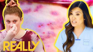 Brittany, 33, has experienced uncomfortable sores all over her body for a number of years. She has seen 8 different doctors because of her sores but none have been able to help her. Will Dr. Lee finally be the one to identify her condition? Dr Pimple Popper: This Is Zit 2810 #pimple #popper #drpimplepopper #drsandralee | Pimple Daily Post